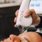 Close up image of a woman's forehead of a woman receiving the moxi laser treatment in Crestwood, Kentucky.